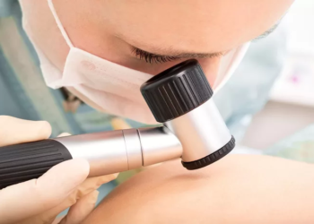 Besplatni dermatovenerološki pregledi akni u više gradova