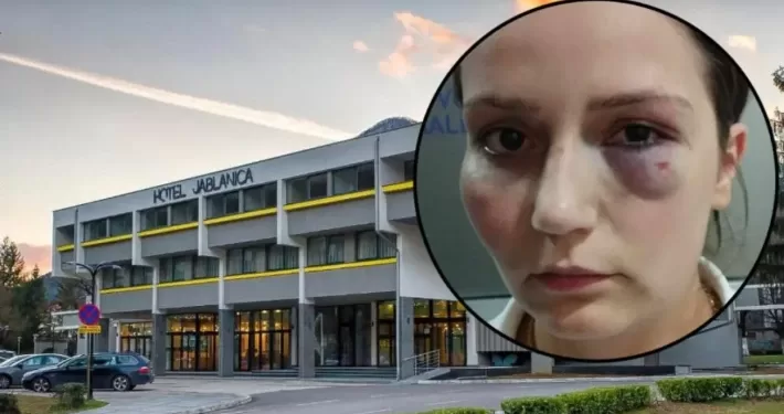 Podrška Enisi: Najavljeni protesti u Jablanici, građani izlaze na ulicu zbog radnice koju je pretukao vlasnik hotela