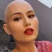 Banjalučanka o borbi sa opakom bolešću: “Kada je teško, čovjek vidi koliko toga može izdržati”