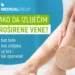 Problem sa proširenim venama? Obratite se banjalučkoj bolnici Medical Group