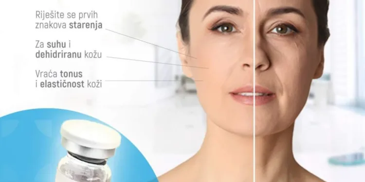 Medical Group Banjaluka: Stigao je novi preparat za biorevitalizaciju NCTF 135 HA