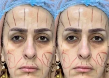 Plastični hirurg pokazao slike prije i poslije operacije: “Mora da vadi nova dokumenta”