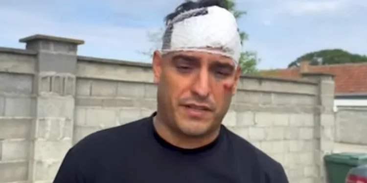 Darko Lazić objasnio kako je došlo do udesa