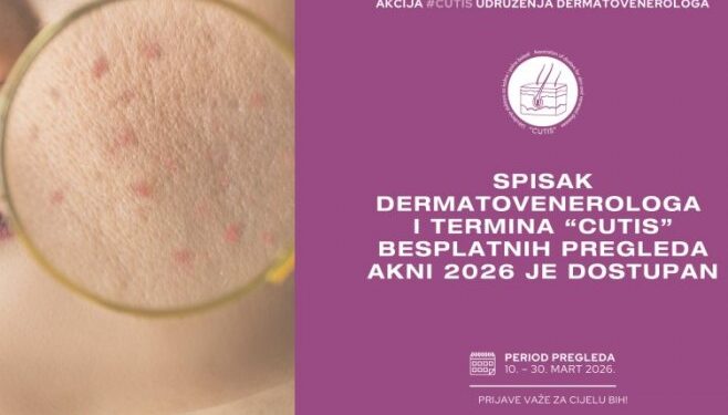 Od danas besplatni dermatološki pregledi akni u Klinici za kožne i polne bolesti UKC Srpske