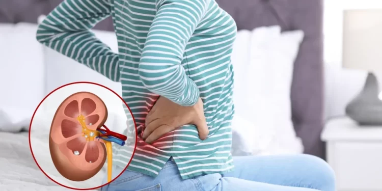 Kamen u bubregu može izazvati i zdrava hrana: Evo na šta treba da pazite