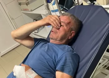 Albanac brutalno pretukao Srbina koji je branio sina