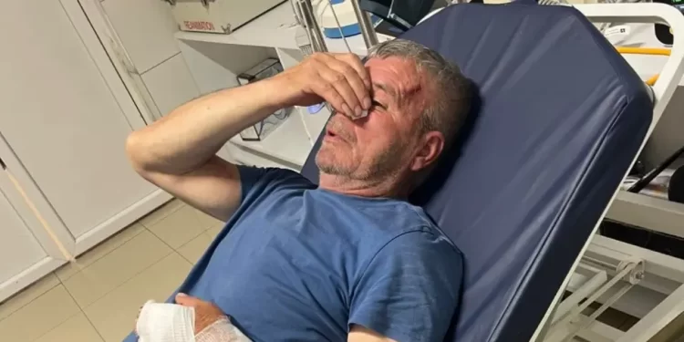Albanac brutalno pretukao Srbina koji je branio sina